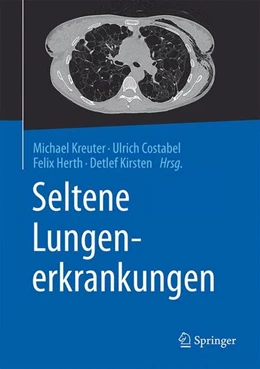 Abbildung von Kreuter / Costabel | Seltene Lungenerkrankungen | 1. Auflage | 2016 | beck-shop.de