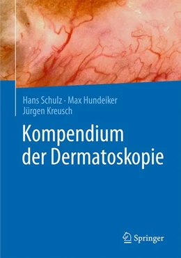 Abbildung von Schulz / Hundeiker | Kompendium der Dermatoskopie | 1. Auflage | 2016 | beck-shop.de