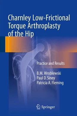 Abbildung von Wroblewski / Siney | Charnley Low-Frictional Torque Arthroplasty of the Hip | 1. Auflage | 2016 | beck-shop.de