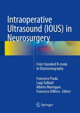 Abbildung von Prada / Solbiati | Intraoperative Ultrasound (IOUS) in Neurosurgery | 1. Auflage | 2016 | beck-shop.de