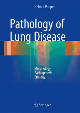 Abbildung von Popper | Pathology of Lung Disease | 1. Auflage | 2017 | beck-shop.de