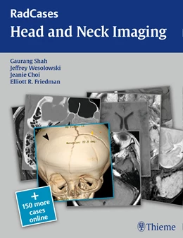 Abbildung von Shah / Wesolowski | RadCases Head and Neck Imaging | 1. Auflage | 2016 | beck-shop.de