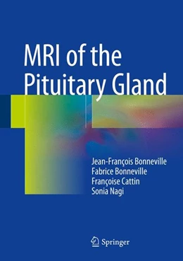 Abbildung von Bonneville / Cattin | MRI of the Pituitary Gland | 1. Auflage | 2016 | beck-shop.de