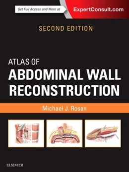 Abbildung von Rosen | Atlas of Abdominal Wall Reconstruction | 2. Auflage | 2016 | beck-shop.de