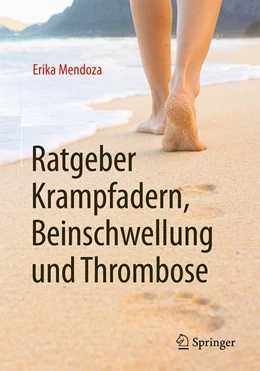 Abbildung von Mendoza | Ratgeber Krampfadern, Beinschwellung und Thrombose | 1. Auflage | 2016 | beck-shop.de