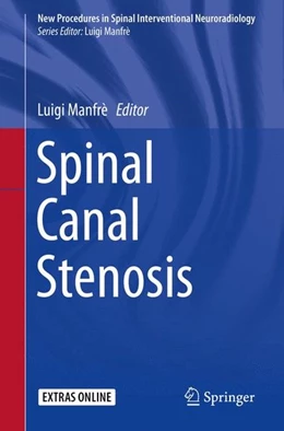 Abbildung von Manfrè | Spinal Canal Stenosis | 1. Auflage | 2016 | beck-shop.de