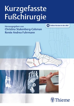 Abbildung von Stukenborg-Colsman / Fuhrmann | Kurzgefasste Fußchirurgie | 1. Auflage | 2021 | beck-shop.de