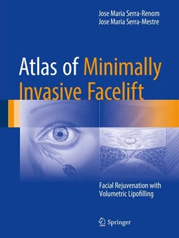 Abbildung von Serra-Renom / Serra-Mestre | Atlas of Minimally Invasive Facelift | 1. Auflage | 2016 | beck-shop.de