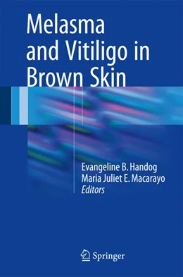 Abbildung von Handog / Enriquez-Macarayo | Melasma and Vitiligo in Brown Skin | 1. Auflage | 2017 | beck-shop.de
