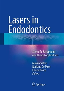 Abbildung von Olivi / De Moor | Lasers in Endodontics | 1. Auflage | 2016 | beck-shop.de