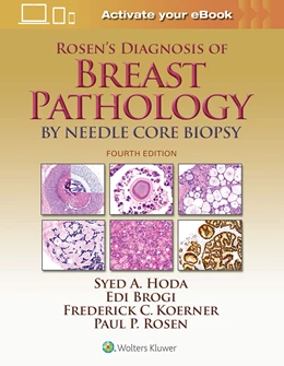 Abbildung von Hoda / Rosen | Rosen's Diagnosis of Breast Pathology by Needle Core Biopsy | 4. Auflage | 2017 | beck-shop.de