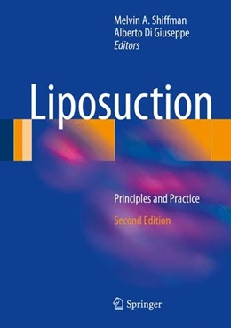 Abbildung von Shiffman / Di Giuseppe | Liposuction | 2. Auflage | 2016 | beck-shop.de
