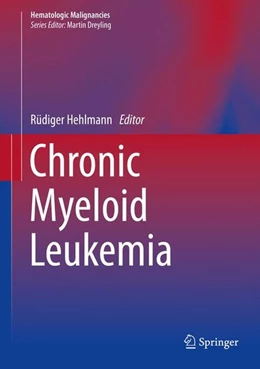 Abbildung von Hehlmann | Chronic Myeloid Leukemia | 1. Auflage | 2016 | beck-shop.de