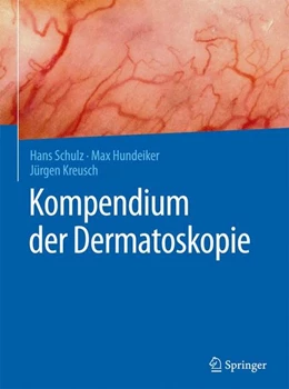 Abbildung von Schulz / Hundeiker | Kompendium der Dermatoskopie | 1. Auflage | 2016 | beck-shop.de