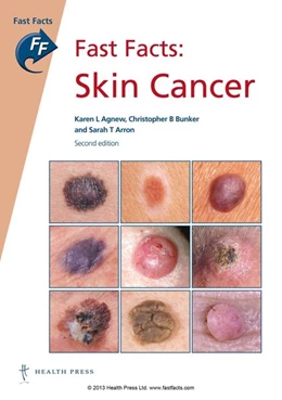 Abbildung von Agnew / Bunker | Fast Facts: Skin Cancer | 2. Auflage | 2015 | beck-shop.de