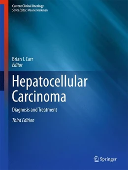 Abbildung von Carr | Hepatocellular Carcinoma | 3. Auflage | 2016 | beck-shop.de