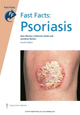 Abbildung von Menter / Smith | Fast Facts: Psoriasis | 4. Auflage | 2014 | beck-shop.de