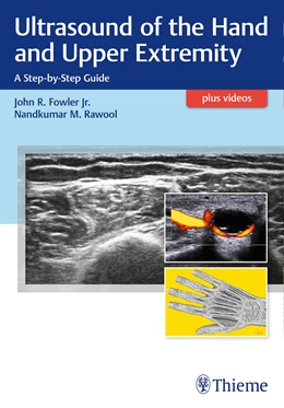 Abbildung von Fowler / Rawool | Ultrasound of the Hand and Upper Extremity | 1. Auflage | 2017 | beck-shop.de