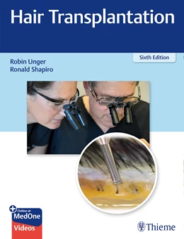Abbildung von Unger / Shapiro | Hair Transplantation | 6. Auflage | 2022 | beck-shop.de
