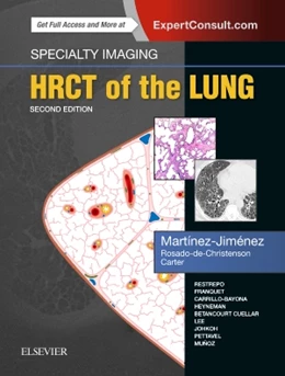 Abbildung von Martínez-Jiménez / Rosado-de-Christenson | Specialty Imaging: HRCT of the Lung | 1. Auflage | 2017 | beck-shop.de
