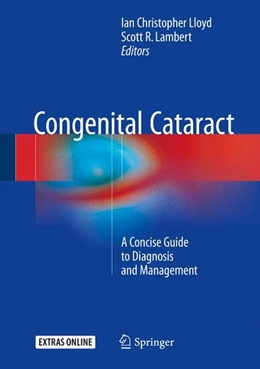 Abbildung von Lloyd / Lambert | Congenital Cataract | 1. Auflage | 2016 | beck-shop.de