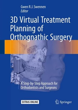 Abbildung von Swennen | 3D Virtual Treatment Planning of Orthognathic Surgery | 1. Auflage | 2016 | beck-shop.de