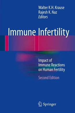 Abbildung von Krause / Naz | Immune Infertility | 2. Auflage | 2016 | beck-shop.de