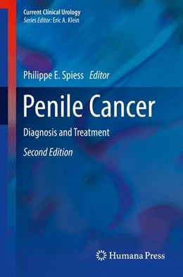 Abbildung von Spiess | Penile Cancer | 2. Auflage | 2016 | beck-shop.de