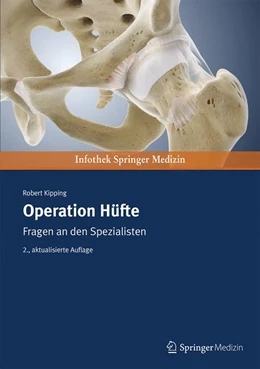 Abbildung von Kipping | Operation Hüfte | 2. Auflage | 2016 | beck-shop.de