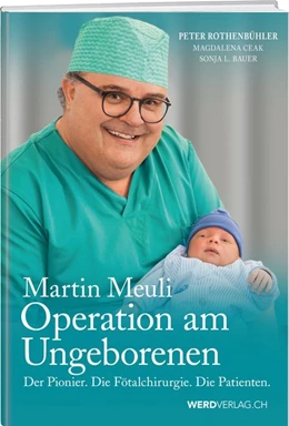 Abbildung von Rothenbühler / Bauer | Martin Meuli - Operation am Ungeborenen | 1. Auflage | 2017 | beck-shop.de