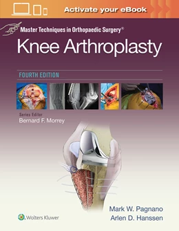 Abbildung von Pagnano / Hanssen | Master Techniques in Orthopedic Surgery: Knee Arthroplasty (Master Techniques in Orthopaedic Surgery) | 1. Auflage | 2019 | beck-shop.de