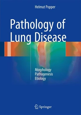 Abbildung von Popper | Pathology of Lung Disease | 1. Auflage | 2016 | beck-shop.de