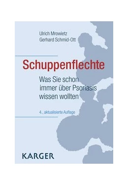Abbildung von Mrowietz / Schmid-Ott | Schuppenflechte | 4. Auflage | 2017 | beck-shop.de