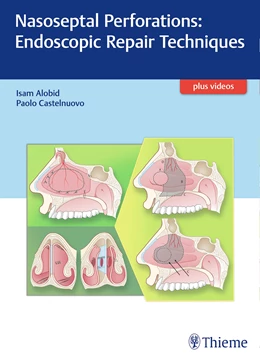 Abbildung von Alobid / Castelnuovo | Nasoseptal Perforations: Endoscopic Repair Techniques | 1. Auflage | 2017 | beck-shop.de