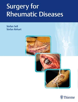 Abbildung von Sell / Rehart | Surgery for Rheumatic Diseases | 1. Auflage | 2017 | beck-shop.de
