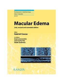 Abbildung von Coscas / Loewenstein | Macular Edema | 2. Auflage | 2017 | beck-shop.de