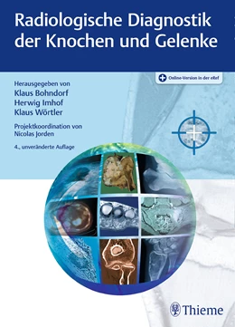Abbildung von Bohndorf / Imhof | Radiologische Diagnostik der Knochen und Gelenke | 4. Auflage | 2017 | beck-shop.de