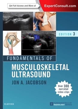 Abbildung von Jacobson | Fundamentals of Musculoskeletal Ultrasound | 3. Auflage | 2017 | beck-shop.de