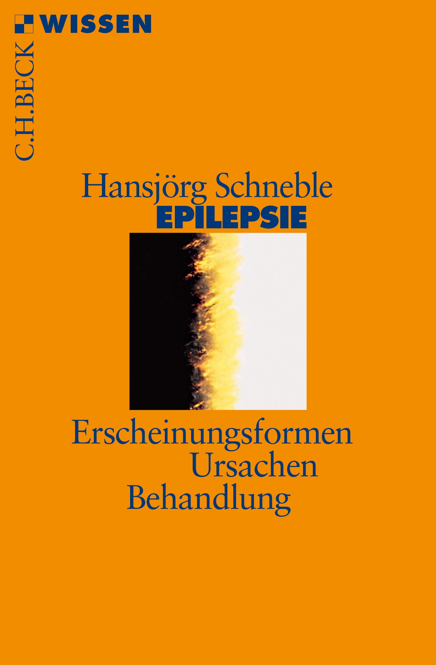 Cover: Schneble, Hansjörg, Epilepsie