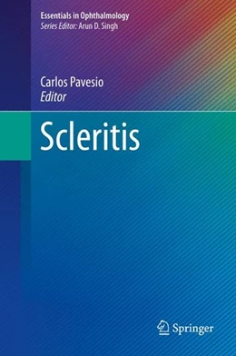 Abbildung von Pavesio | Scleritis | 1. Auflage | 2017 | beck-shop.de