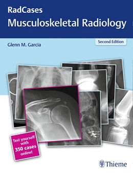 Abbildung von Garcia | Radcases Musculoskeletal Radiology | 2. Auflage | 2017 | beck-shop.de
