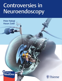 Abbildung von Nakaji / Zaidi | Controversies in Neuroendoscopy | 1. Auflage | 2019 | beck-shop.de