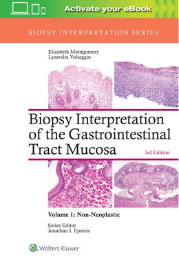 Abbildung von Montgomery / Voltaggio | Biopsy Interpretation of the Gastrointestinal Tract Mucosa: Volume 1: Non-Neoplastic | 3. Auflage | 2017 | beck-shop.de