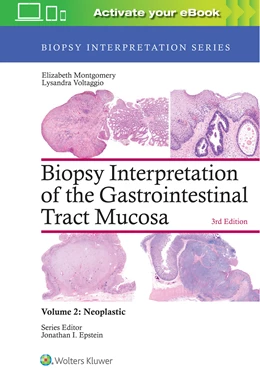 Abbildung von Montgomery / Voltaggio | Biopsy Interpretation of the Gastrointestinal Tract Mucosa: Volume 2: Neoplastic | 3. Auflage | 2017 | beck-shop.de