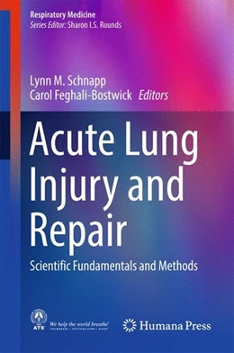 Abbildung von Schnapp / Feghali-Bostwick | Acute Lung Injury and Repair | 1. Auflage | 2016 | beck-shop.de
