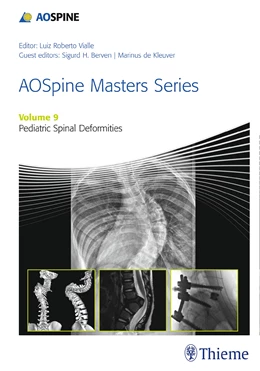 Abbildung von Kleuver / Berven | AOSpine Masters Series, Volume 9: Pediatric Spinal Deformities | 1. Auflage | 2017 | beck-shop.de