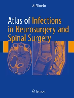 Abbildung von Akhaddar | Atlas of Infections in Neurosurgery and Spinal Surgery | 1. Auflage | 2017 | beck-shop.de