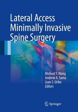 Abbildung von Wang / Sama | Lateral Access Minimally Invasive Spine Surgery | 1. Auflage | 2016 | beck-shop.de