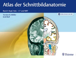 Abbildung von Möller / Reif | Atlas der Schnittbildanatomie • Band I: Kopf, Hals | 1. Auflage | 2018 | beck-shop.de