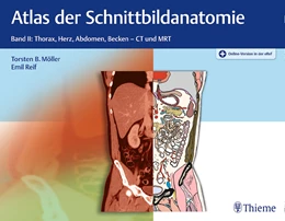 Abbildung von Möller / Reif | Atlas der Schnittbildanatomie • Band II: Thorax, Herz, Abdomen, Becken | 1. Auflage | 2018 | beck-shop.de